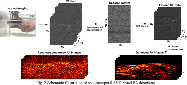 Figure 2 for Spatiotemporal singular value decomposition for denoising in photoacoustic imaging with low-energy excitation light source