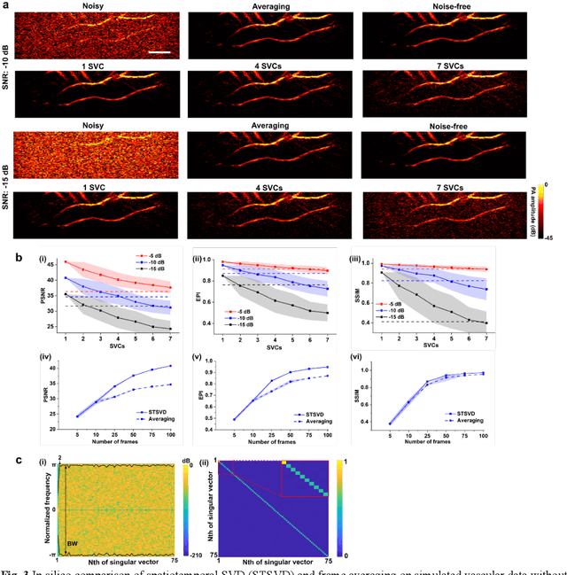Figure 3 for Spatiotemporal singular value decomposition for denoising in photoacoustic imaging with low-energy excitation light source