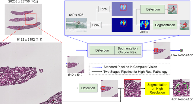 Figure 1 for Instance Segmentation for Whole Slide Imaging: End-to-End or Detect-Then-Segment