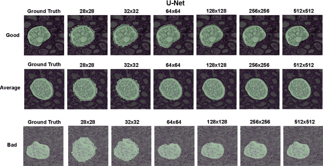 Figure 3 for Instance Segmentation for Whole Slide Imaging: End-to-End or Detect-Then-Segment