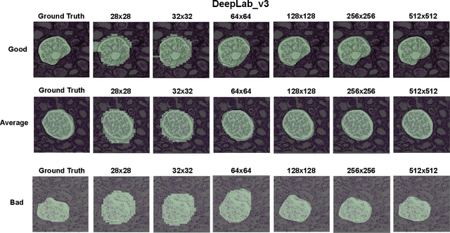 Figure 4 for Instance Segmentation for Whole Slide Imaging: End-to-End or Detect-Then-Segment