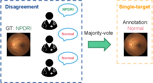 Figure 1 for Improving Medical Image Classification with Label Noise Using Dual-uncertainty Estimation