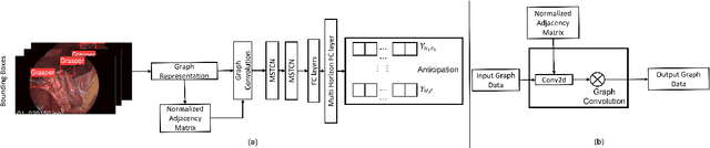 Figure 1 for Towards Graph Representation Learning Based Surgical Workflow Anticipation