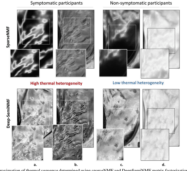 Figure 2 for Embedded Deep Regularized Block HSIC Thermomics for Early Diagnosis of Breast Cancer