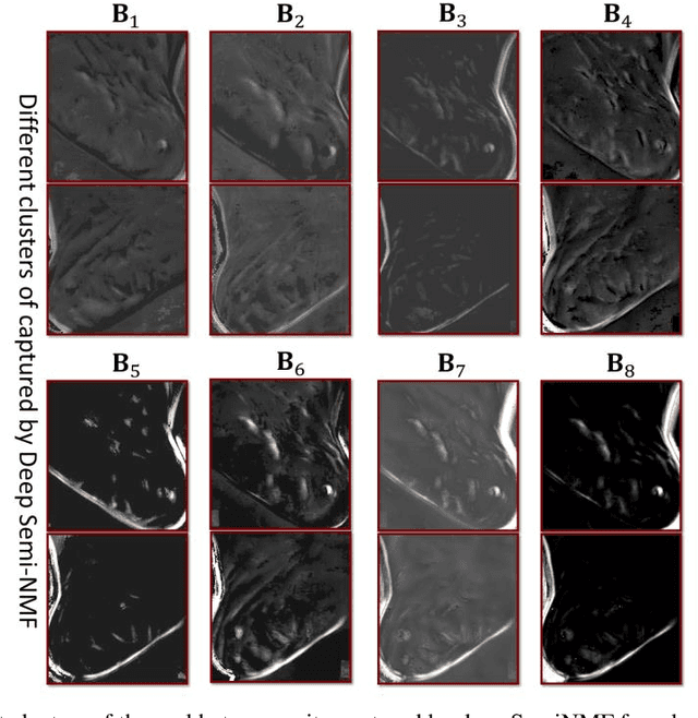 Figure 3 for Embedded Deep Regularized Block HSIC Thermomics for Early Diagnosis of Breast Cancer