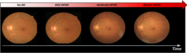 Figure 1 for Detection of diabetic retinopathy using longitudinal self-supervised learning