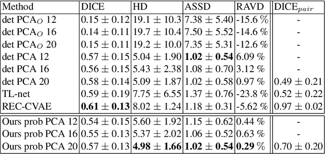 Figure 2 for Probabilistic 3D surface reconstruction from sparse MRI information