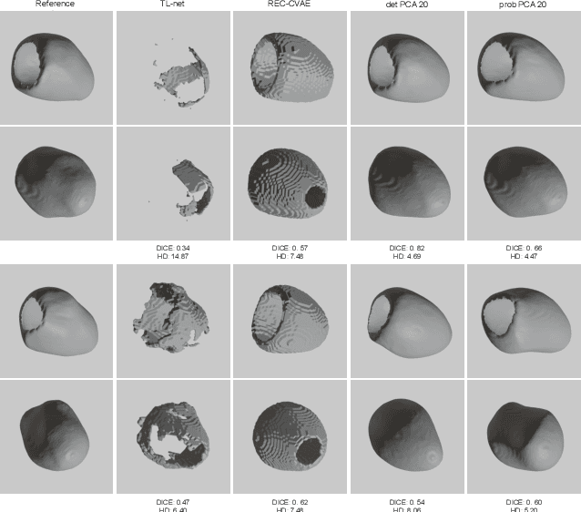 Figure 3 for Probabilistic 3D surface reconstruction from sparse MRI information