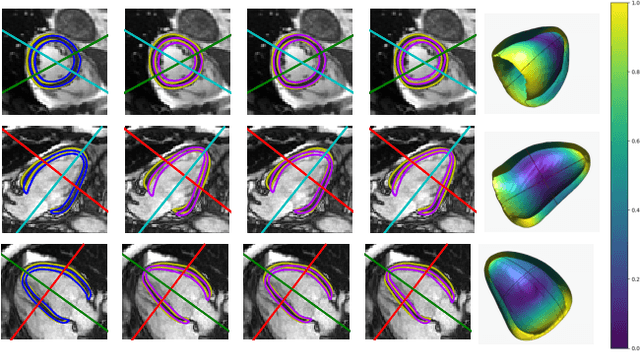 Figure 4 for Probabilistic 3D surface reconstruction from sparse MRI information