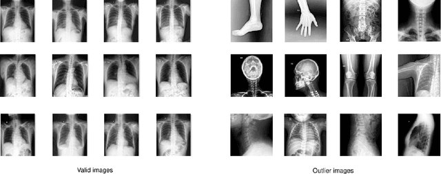 Figure 3 for VinDr-CXR: An open dataset of chest X-rays with radiologist's annotations