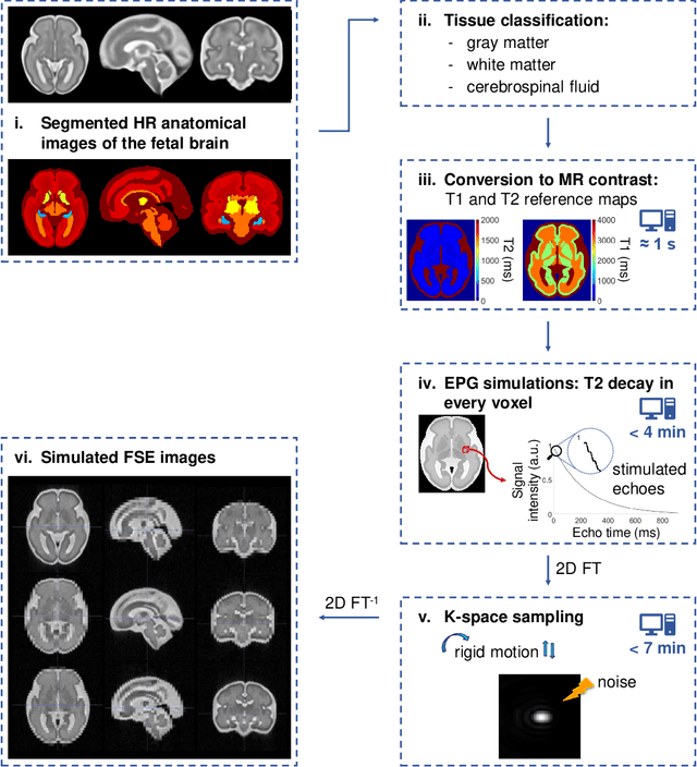 Figure 2 for FaBiAN: A Fetal Brain magnetic resonance Acquisition Numerical phantom
