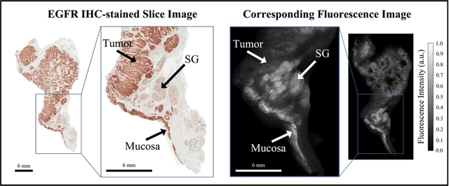 Figure 1 for Fluorescence molecular optomic signatures improve identification of tumors in head and neck specimens