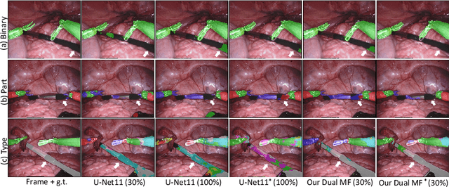 Figure 3 for Learning Motion Flows for Semi-supervised Instrument Segmentation from Robotic Surgical Video