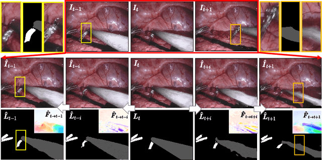 Figure 4 for Learning Motion Flows for Semi-supervised Instrument Segmentation from Robotic Surgical Video