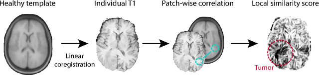 Figure 3 for Memory efficient brain tumor segmentation using an autoencoder-regularized U-Net