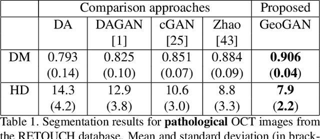 Figure 2 for Pathological Retinal Region Segmentation From OCT Images Using Geometric Relation Based Augmentation