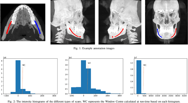 Figure 1 for Dual-Stage Deeply Supervised Attention-based Convolutional Neural Networks for Mandibular Canal Segmentation in CBCT Scans