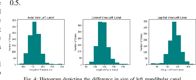 Figure 3 for Dual-Stage Deeply Supervised Attention-based Convolutional Neural Networks for Mandibular Canal Segmentation in CBCT Scans