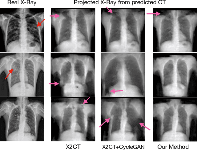 Figure 1 for Improving Computed Tomography (CT) Reconstruction via 3D Shape Induction