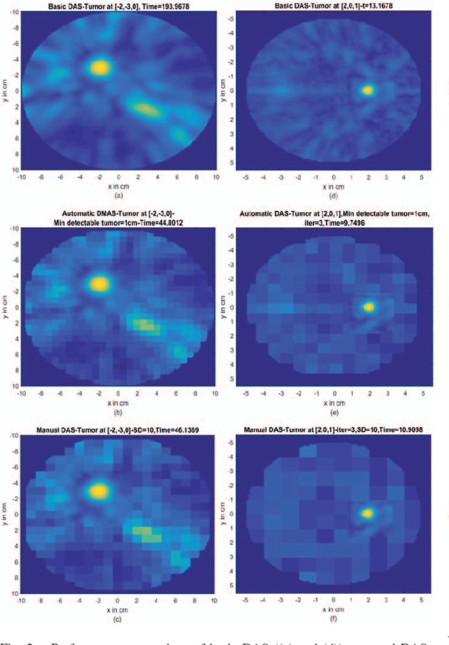 Figure 2 for A Novel Low-Complexity Framework in Ultra-Wideband Imaging for Breast Cancer Detection