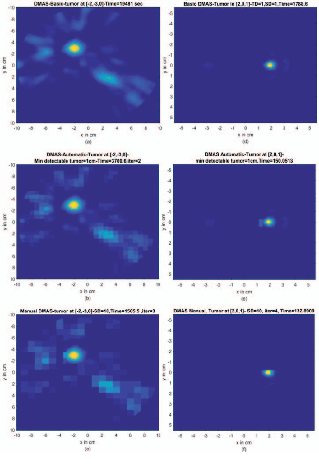 Figure 3 for A Novel Low-Complexity Framework in Ultra-Wideband Imaging for Breast Cancer Detection