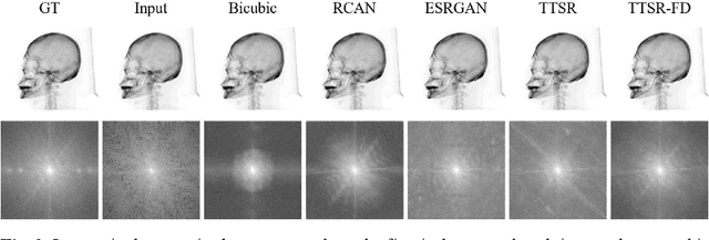 Figure 3 for A Frequency Domain Constraint for Synthetic X-ray Image Super Resolution