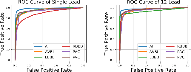 Figure 4 for CardioLearn: A Cloud Deep Learning Service for Cardiac Disease Detection from Electrocardiogram