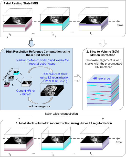 Figure 2 for Motion Correction and Volumetric Reconstruction for Fetal Functional Magnetic Resonance Imaging Data