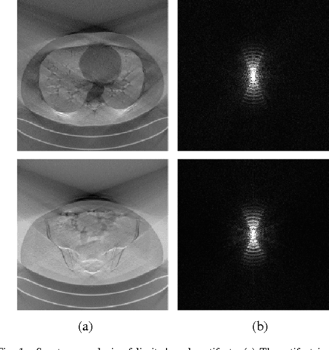 Figure 1 for Multi-Scale Wavelet Domain Residual Learning for Limited-Angle CT Reconstruction