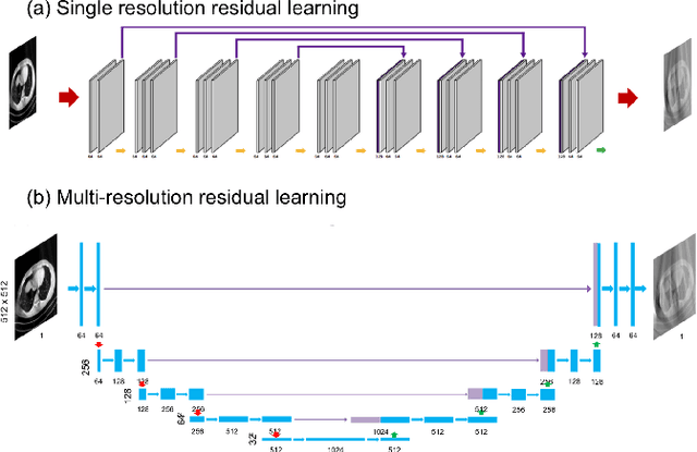 Figure 4 for Multi-Scale Wavelet Domain Residual Learning for Limited-Angle CT Reconstruction