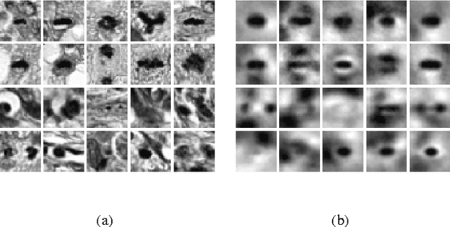 Figure 3 for Unsupervised Learning with Imbalanced Data via Structure Consolidation Latent Variable Model