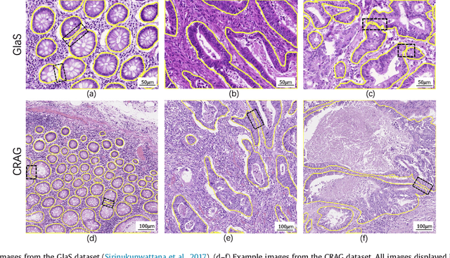 Figure 1 for MILD-Net: Minimal Information Loss Dilated Network for Gland Instance Segmentation in Colon Histology Images