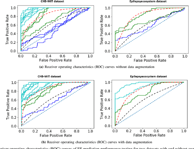 Figure 4 for A Generative Model to Synthesize EEG Data for Epileptic Seizure Prediction