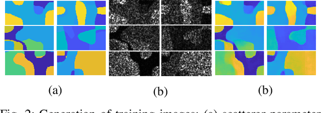 Figure 2 for Deep Network for Scatterer Distribution Estimation for Ultrasound Image Simulation