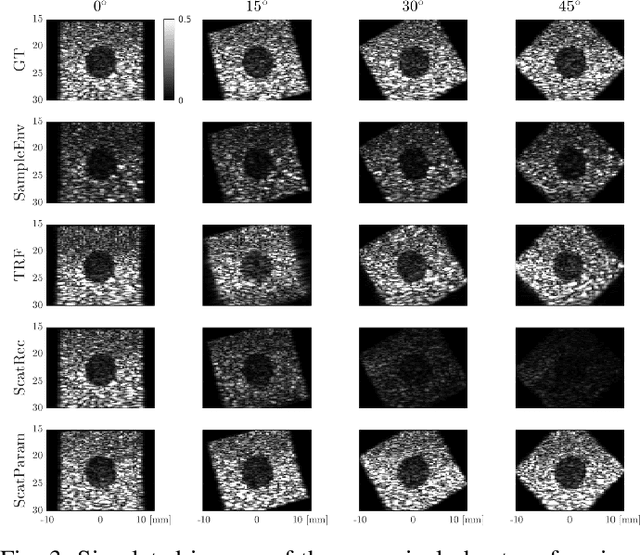 Figure 3 for Deep Network for Scatterer Distribution Estimation for Ultrasound Image Simulation