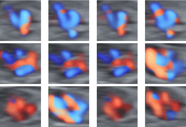 Figure 1 for Segmentation of points of interest during fetal cardiac assesment in the first trimester from color Doppler ultrasound