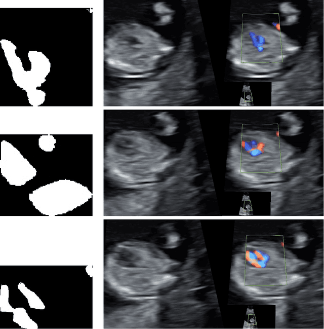 Figure 2 for Segmentation of points of interest during fetal cardiac assesment in the first trimester from color Doppler ultrasound