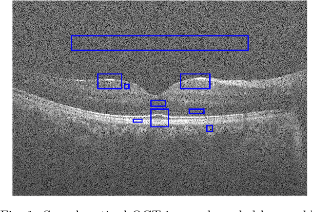 Figure 1 for Application of Independent Component Analysis Techniques in Speckle Noise Reduction of Retinal OCT Images