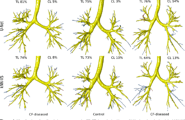 Figure 4 for Automatic airway segmentation from Computed Tomography using robust and efficient 3-D convolutional neural networks