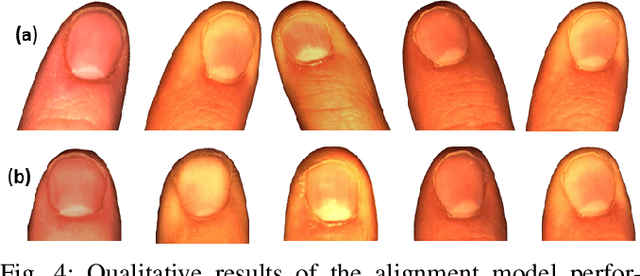 Figure 4 for Real-Time Tactile Grasp Force Sensing Using Fingernail Imaging via Deep Neural Networks