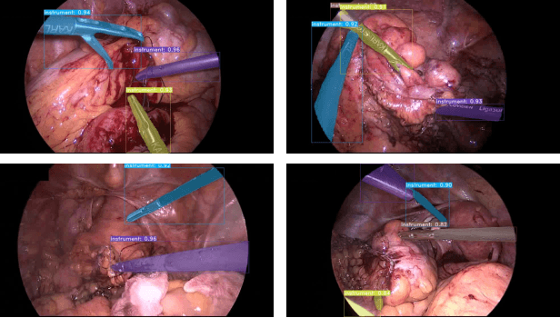Figure 4 for Assessing YOLACT++ for real time and robust instance segmentation of medical instruments in endoscopic procedures