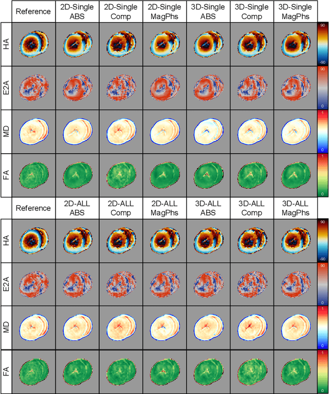 Figure 2 for Review of data types and model dimensionality for cardiac DTI SMS-related artefact removal