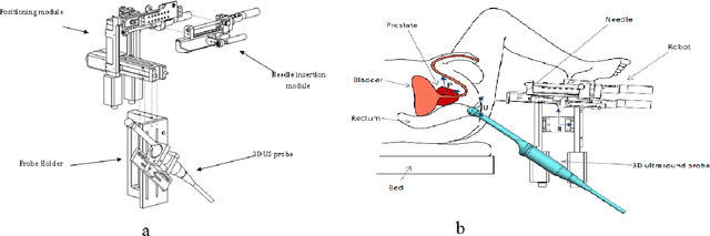 Figure 1 for Development of a Novel Robot for Transperineal Needle Based Interventions: Focal Therapy, Brachytherapy and Prostate Biopsies