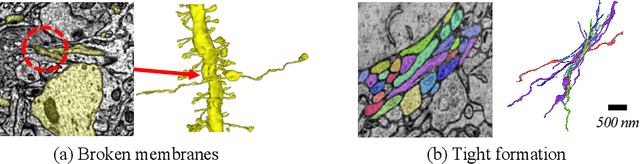 Figure 1 for AxonEM Dataset: 3D Axon Instance Segmentation of Brain Cortical Regions