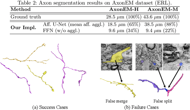 Figure 4 for AxonEM Dataset: 3D Axon Instance Segmentation of Brain Cortical Regions