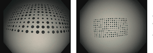 Figure 3 for EndoMapper dataset of complete calibrated endoscopy procedures