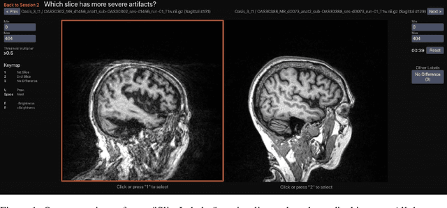 Figure 1 for Decreasing Annotation Burden of Pairwise Comparisons with Human-in-the-Loop Sorting: Application in Medical Image Artifact Rating