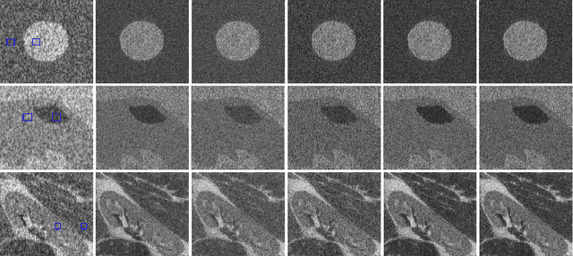 Figure 2 for Preconditioned P-ULA for Joint Deconvolution-Segmentation of Ultrasound Images