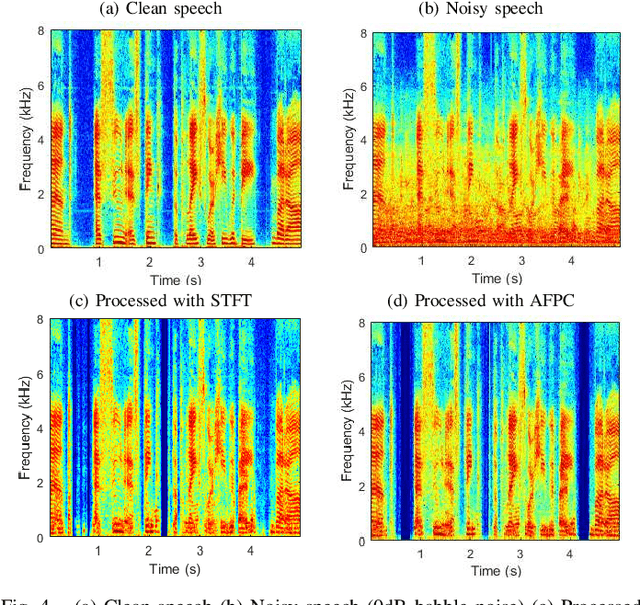 Figure 4 for On the Use of Audio Fingerprinting Features for Speech Enhancement with Generative Adversarial Network
