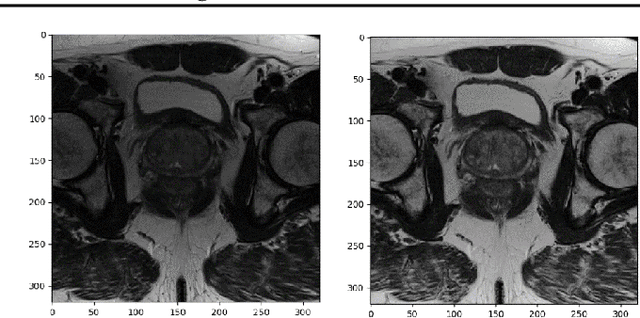 Figure 3 for Prostate Lesion Detection and Salient Feature Assessment Using Zone-Based Classifiers
